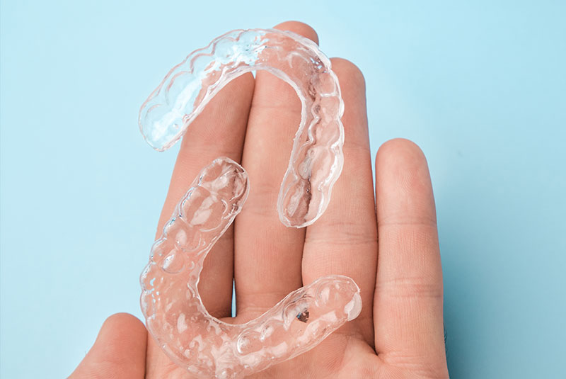 close up of aligners