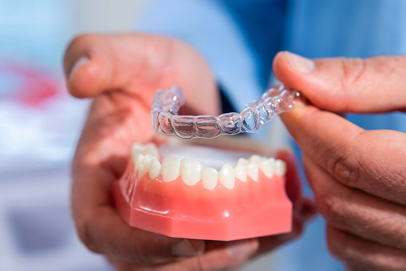close up of model arch being used along with aligner