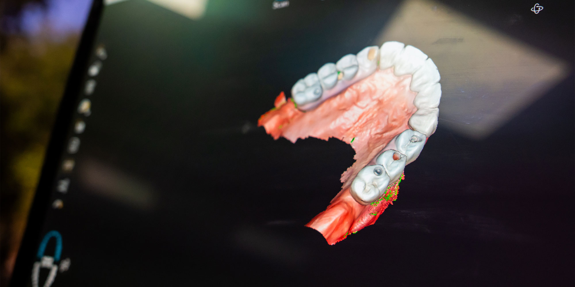 display of dental procedure operation
